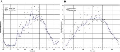 Between-rater reliability for using radar technology to quantify maximal horizontal deceleration performance in NCAA division 1 American football and female lacrosse athletes